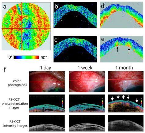 optical coherence tomography review